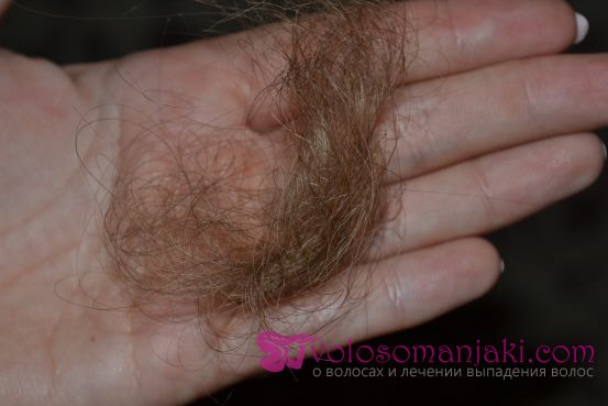 Как справится с интенсивным выпадением волос. История длиной в три года #2