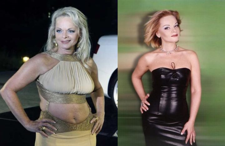 Полная диета Ларисы Долиной: фото  до и после #1
