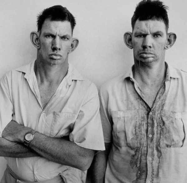 Что стало со знаменитыми близнецами на фотографии 1993 года (фото) #1