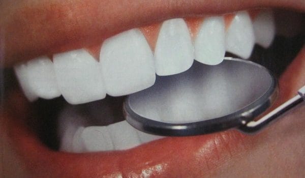 Картинки зубов на аву (100 фото) #27